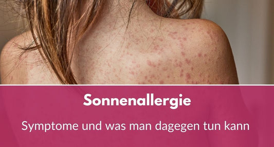 sonnenallergie was tun