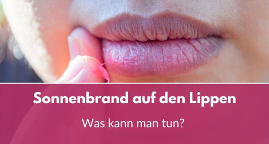 sonnenbrand lippen